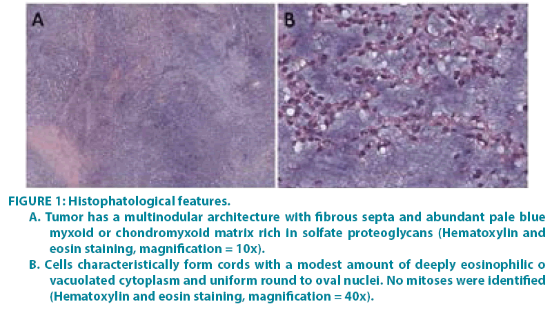 clinical-practice-Histophatological-features