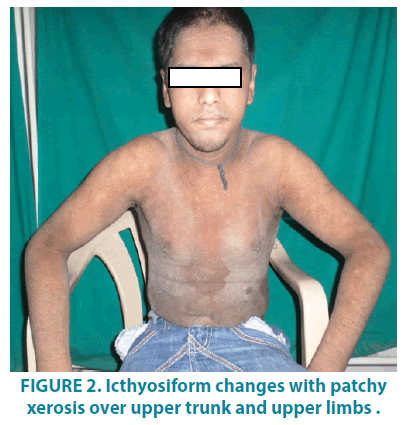 clinical-practice-Icthyosiform