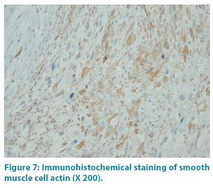 clinical-practice-Immunohistochemical