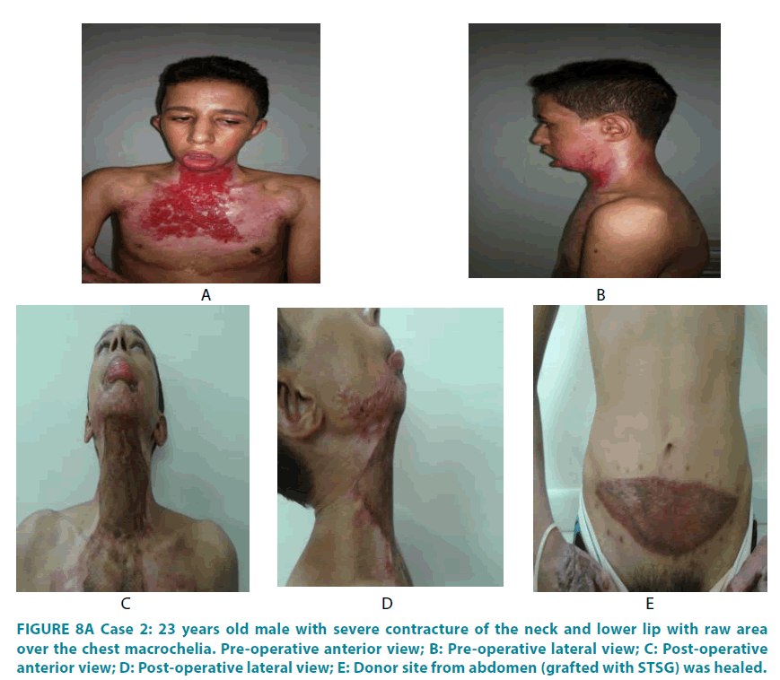 clinical-practice-Pre-operative-anterior