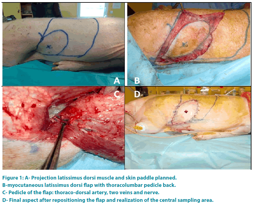 clinical-practice-Projection-latissimus