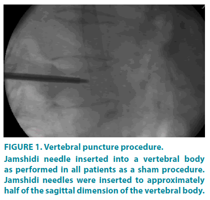 clinical-practice-Vertebral-puncture