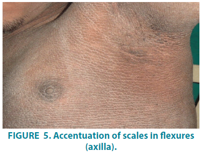 clinical-practice-axilla