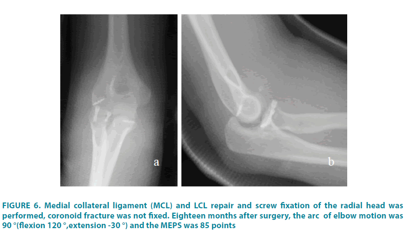 clinical-practice-collateral-ligament