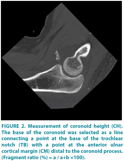 clinical-practice-coronoid-height