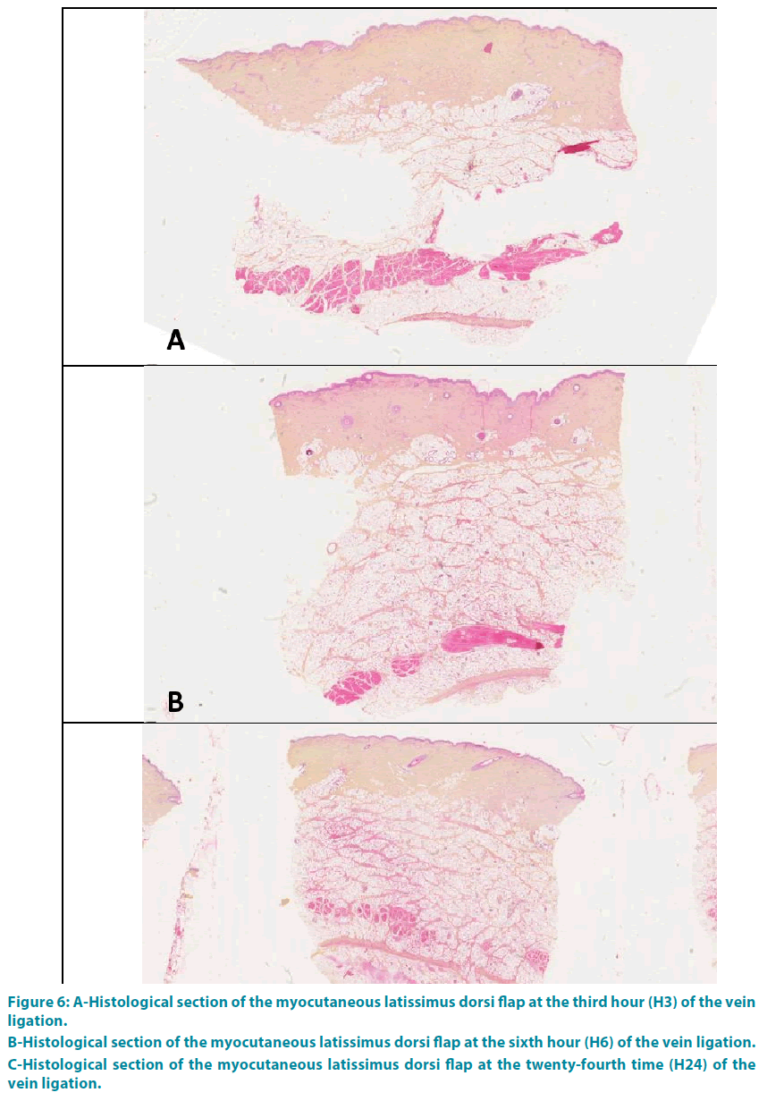 clinical-practice-dorsi-flap