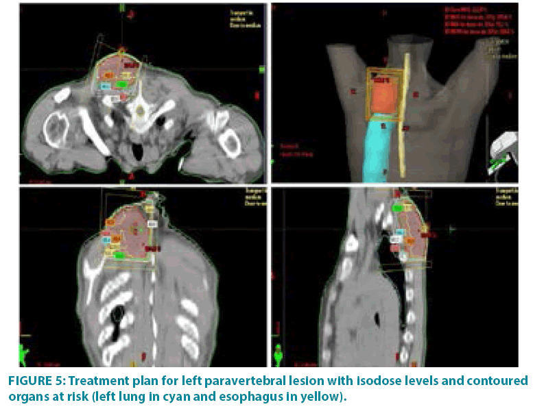 clinical-practice-esophagus-in-yellow