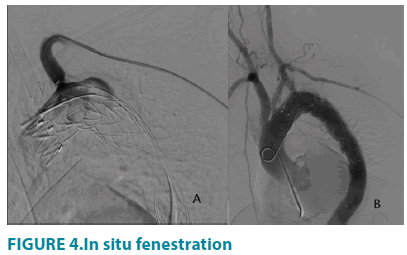 clinical-practice-fenestration