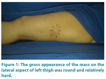 clinical-practice-gross-appearance