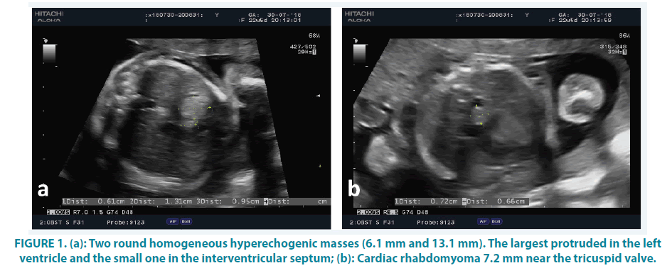 clinical-practice-hyperechogenic