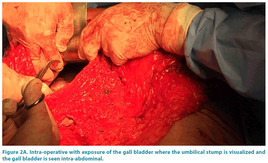 clinical-practice-intra-abdominal