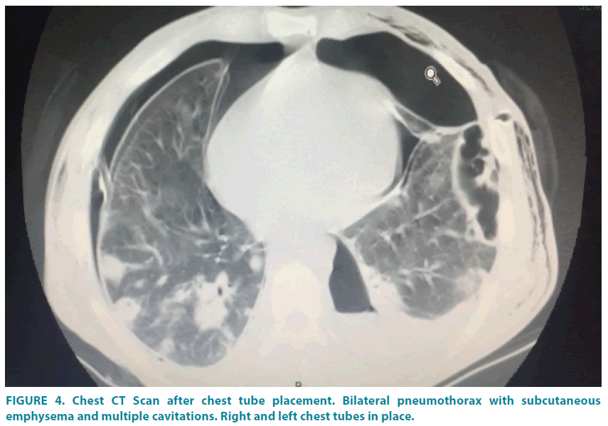 clinical-practice-multiple-cavitations