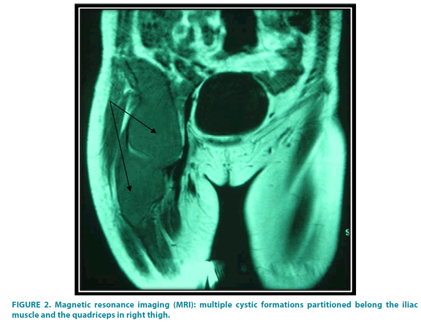 clinical-practice-multiple-cystic