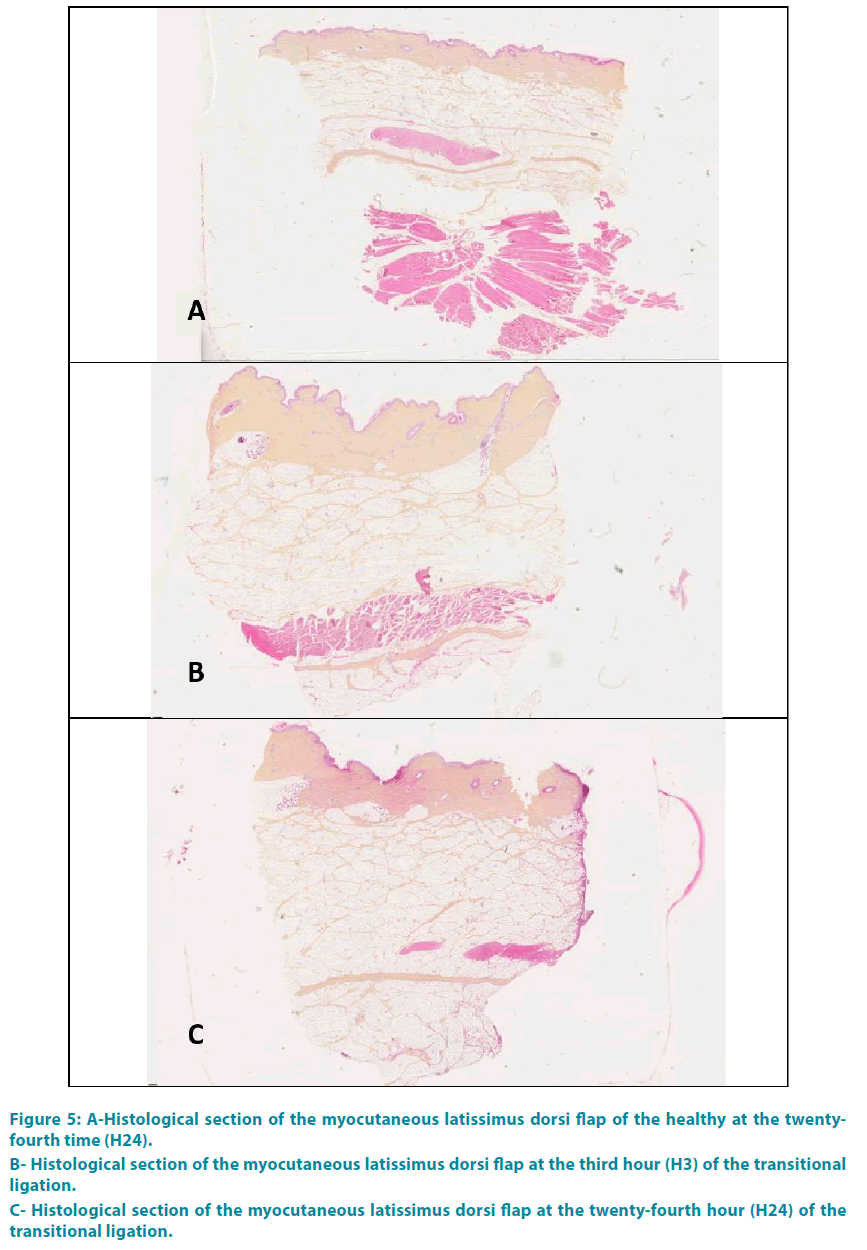 clinical-practice-myocutaneous