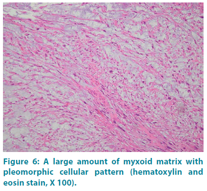 clinical-practice-myxoid-matrix