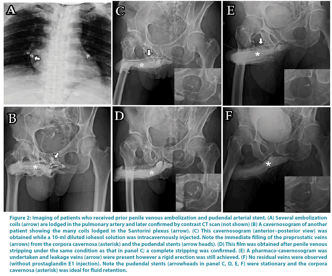 clinical-practice-penile-venous