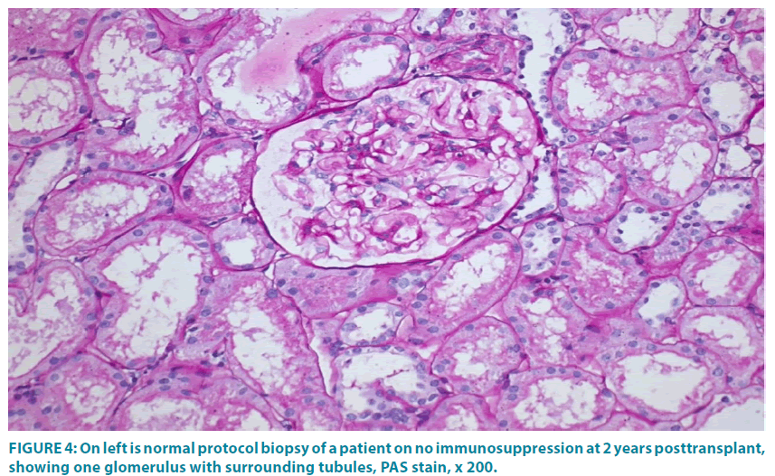 clinical-practice-protocol-biopsy