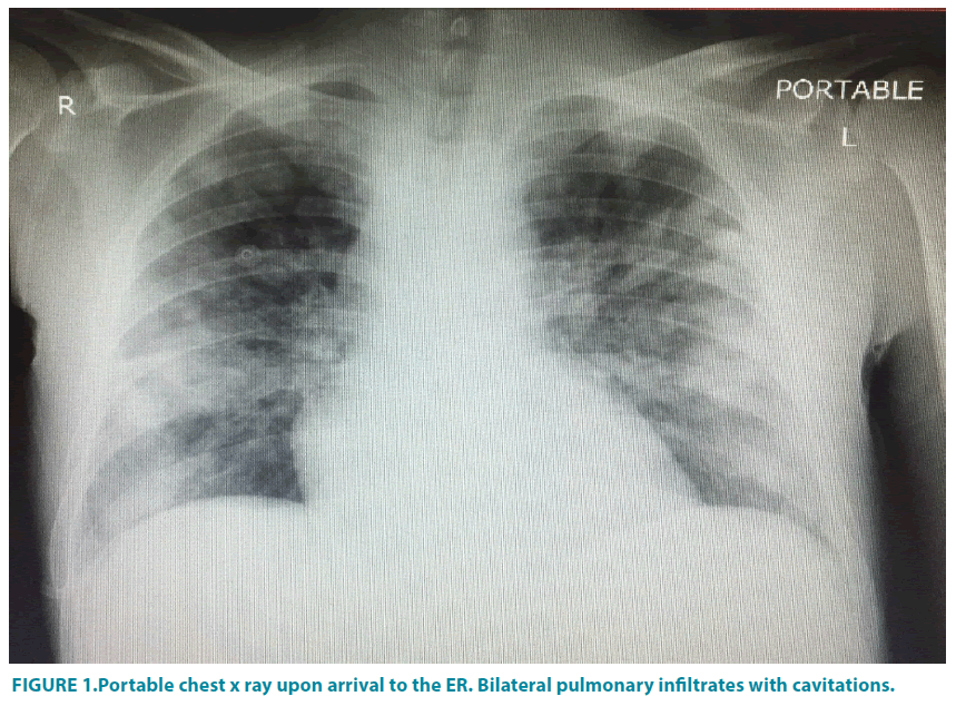 clinical-practice-pulmonary-infiltrates