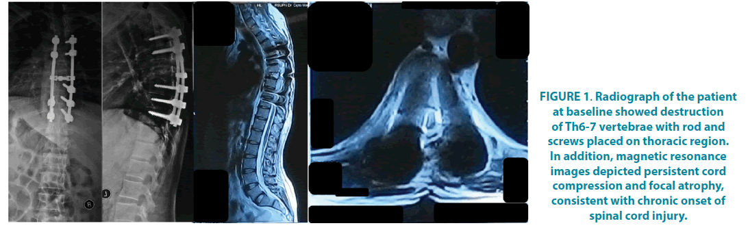 clinical-practice-screws-placed