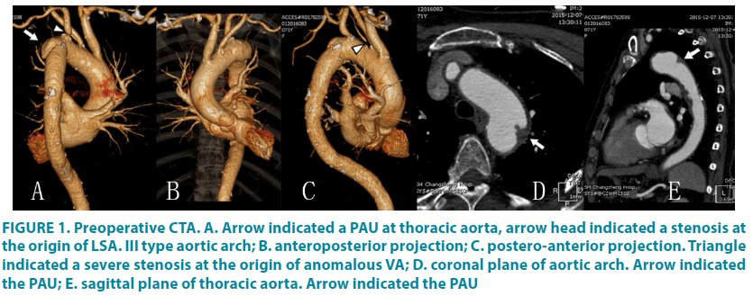 clinical-practice-severe-stenosis