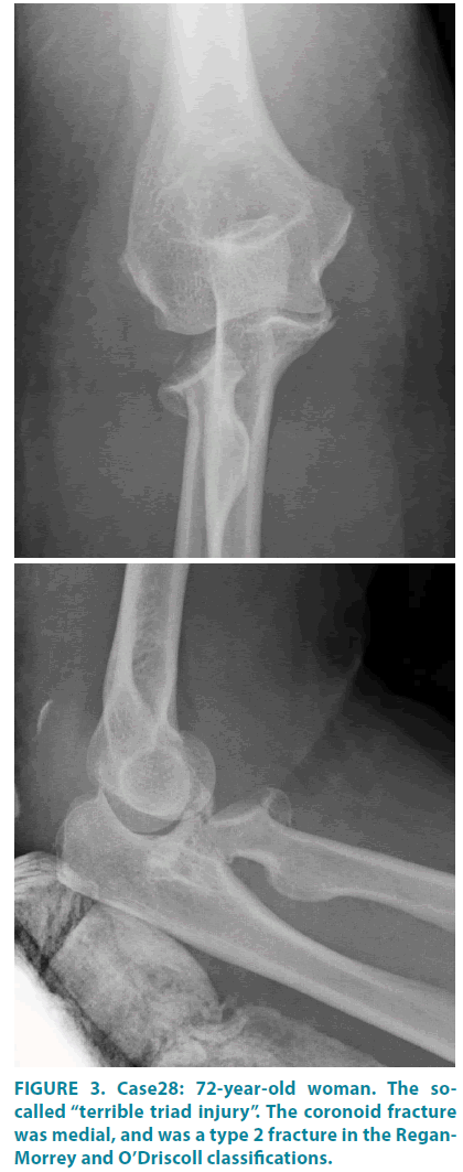 clinical-practice-terrible-triad-injury