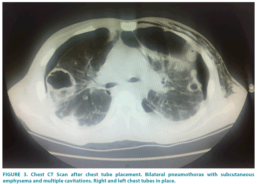 clinical-practice-tube-placement