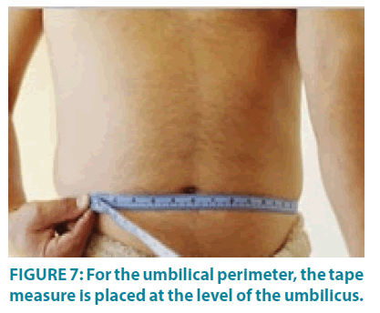 clinical-practice-umbilical-perimeter