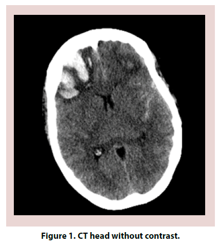 clinical-rheumatology-CT-head