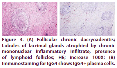 clinical-rheumatology-Follicular-chronic