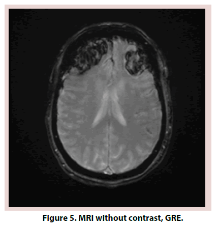 clinical-rheumatology-GRE