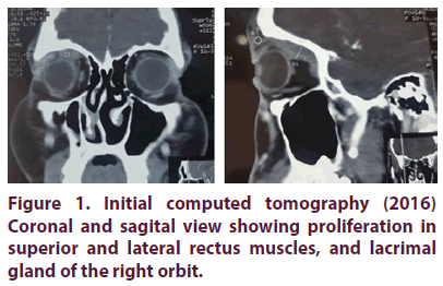clinical-rheumatology-Initial-computed-tomography