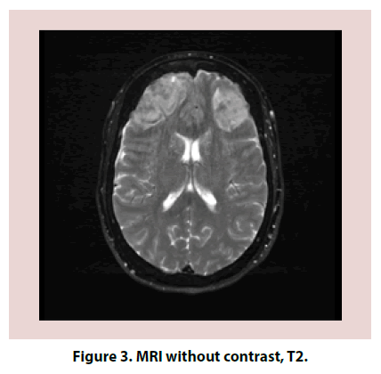 clinical-rheumatology-MRI