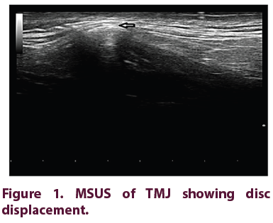 clinical-rheumatology-MSUS-TMJ