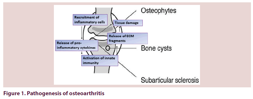 clinical-rheumatology-Pathogenesis-osteoarthritis