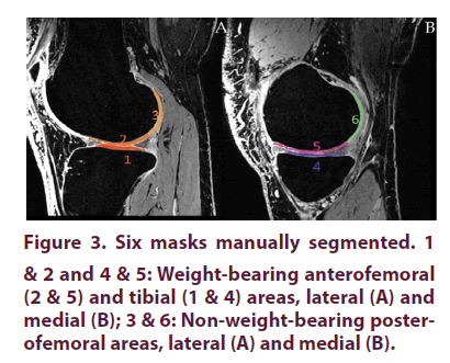 clinical-rheumatology-Six-masks