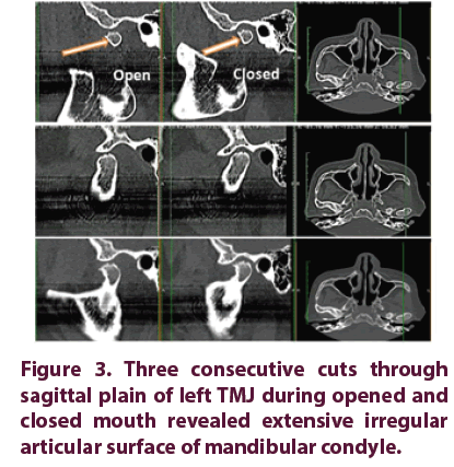 clinical-rheumatology-Three-consecutive