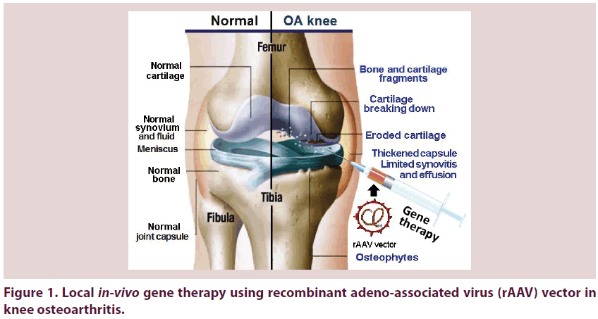 clinical-rheumatology-adeno-associated-virus