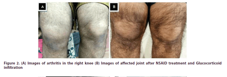 clinical-rheumatology-affected