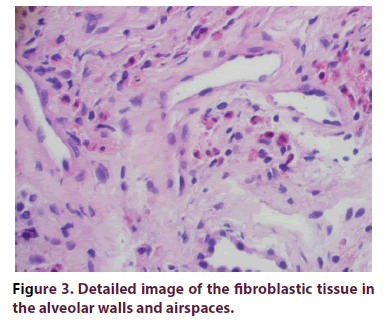 clinical-rheumatology-alveolar