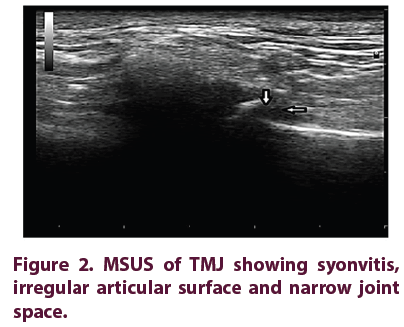 clinical-rheumatology-articular-surface