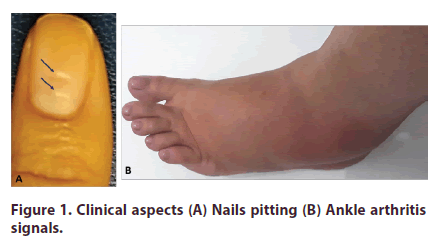 clinical-rheumatology-aspects