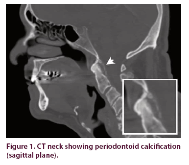 clinical-rheumatology-calcification