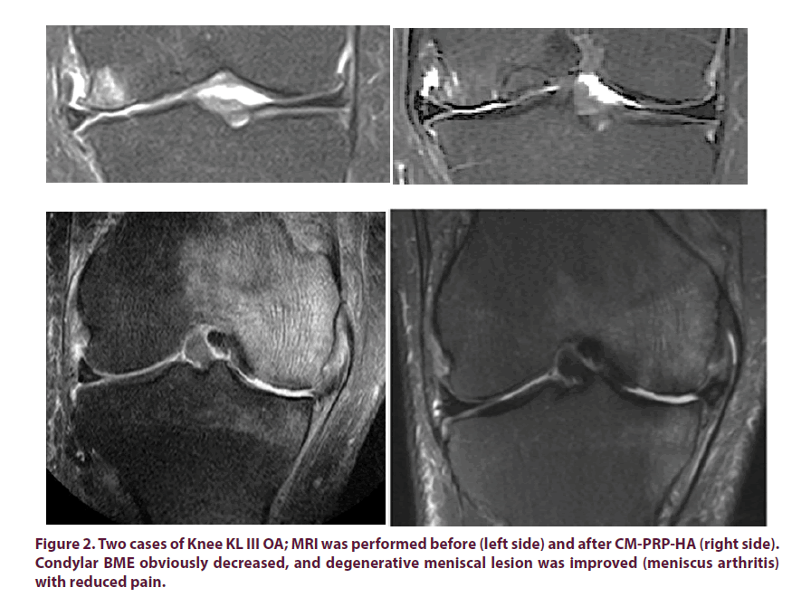 clinical-rheumatology-cases-Knee