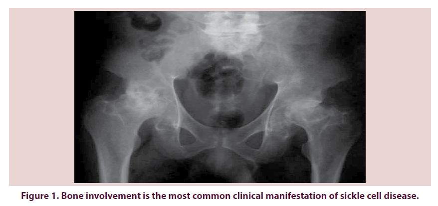 clinical-rheumatology-cell-disease