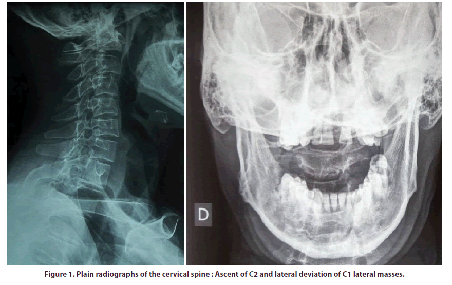 clinical-rheumatology-cervical