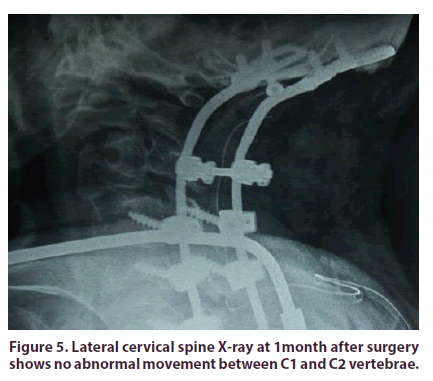 clinical-rheumatology-cervical