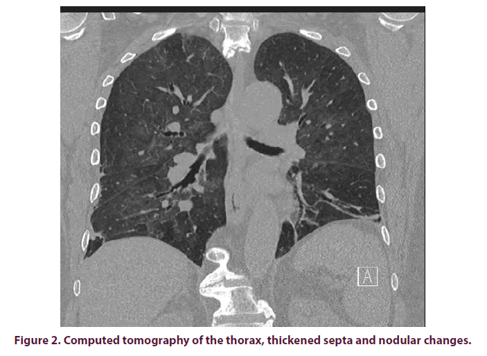 clinical-rheumatology-computed-tomography