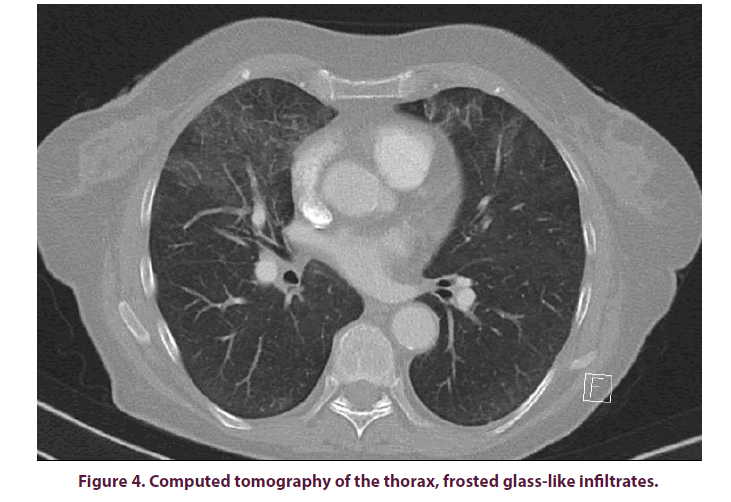 clinical-rheumatology-computed-tomography