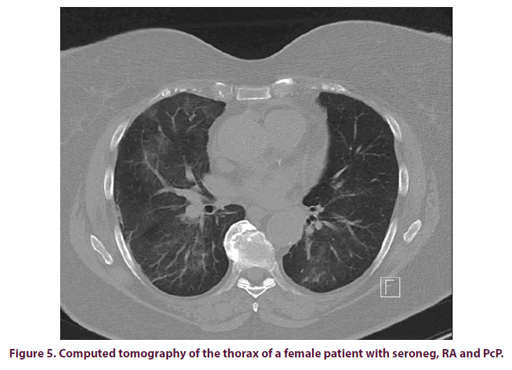 clinical-rheumatology-computed-tomography