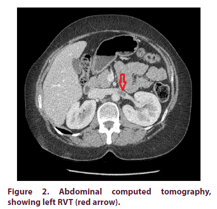 clinical-rheumatology-computed-tomography